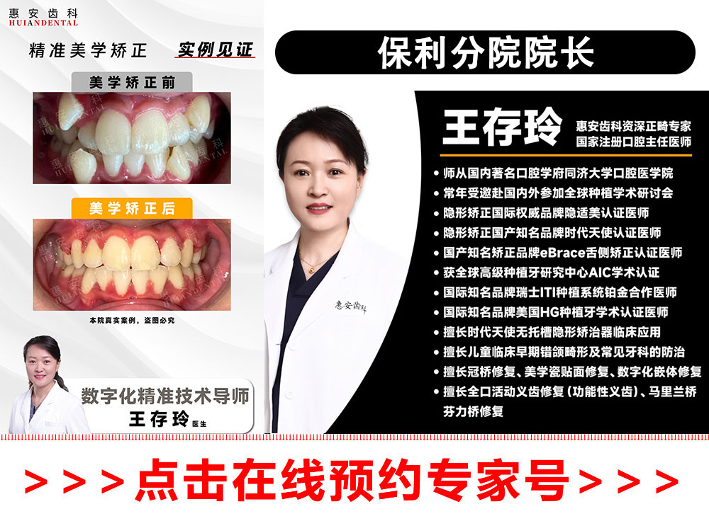 兰州牙齿矫正,兰州矫正牙齿,兰州正畸,兰州正畸专家,兰州牙齿矫正专家