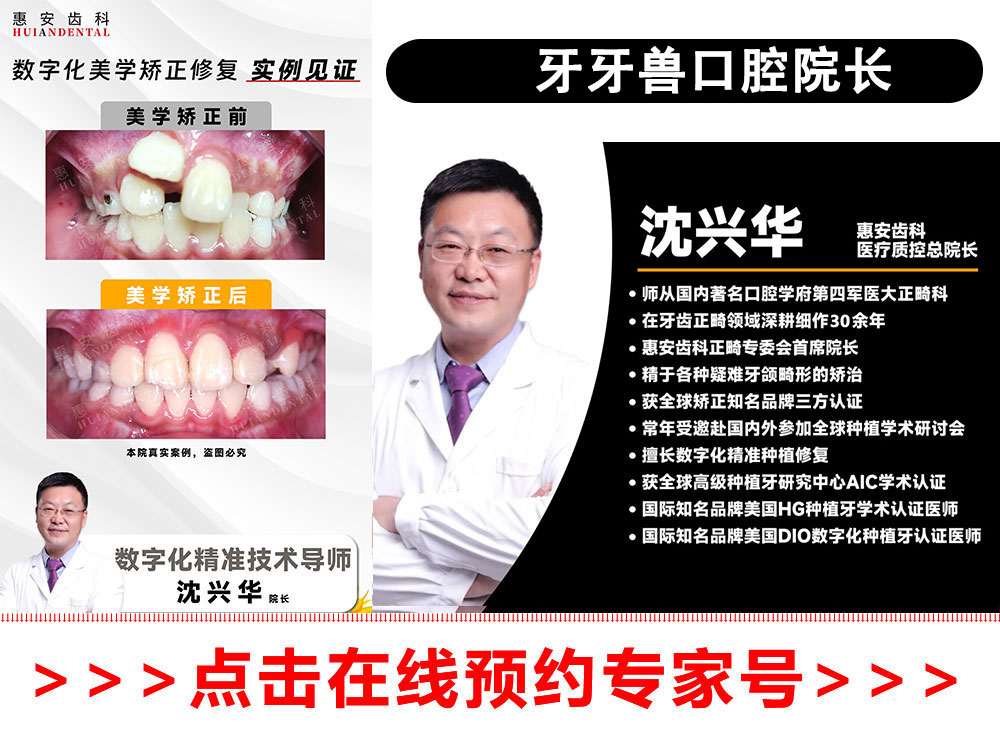 兰州牙科，兰州口腔，兰州矫正牙齿，兰州牙齿矫正，兰州正畸，兰州矫正牙齿哪家好，兰州正畸